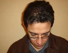 Slider image (6) Vita Hair | Clinica Capilar